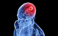 La intervención neurorrehabilitadora debe iniciarse desde el primer momento en que la situación de la persona afectada lo permita.